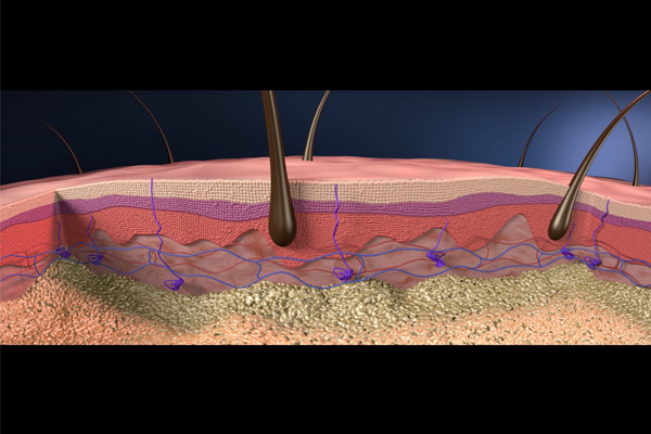 Atopic Dermatitis: Using VR to Decrease Cognitive Load to Understand New Therapeutic Approaches by Med Learning Group