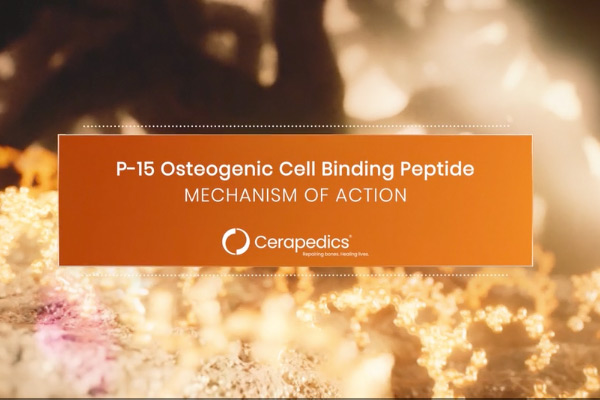 Bone Regeneration Animation by Random42 Scientific Communication