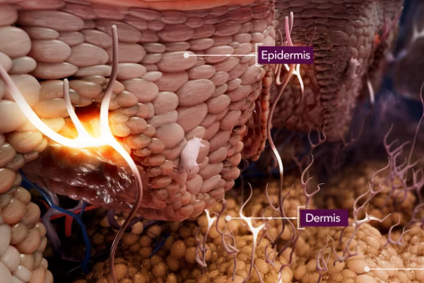 Chronic Itch Virtual Reality by Random42 Scientific Communication